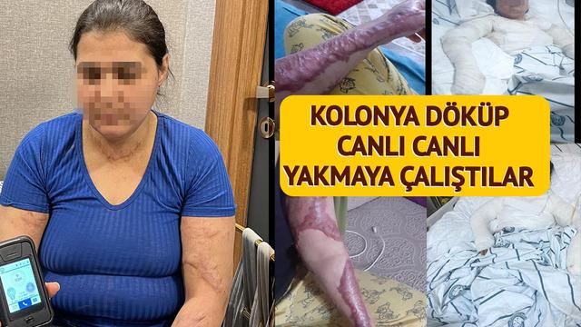 Her kelimesi insanlık dışı: Bacağına sıcak ütü bastılar, kolonya döküp canlı canlı yakmak istediler