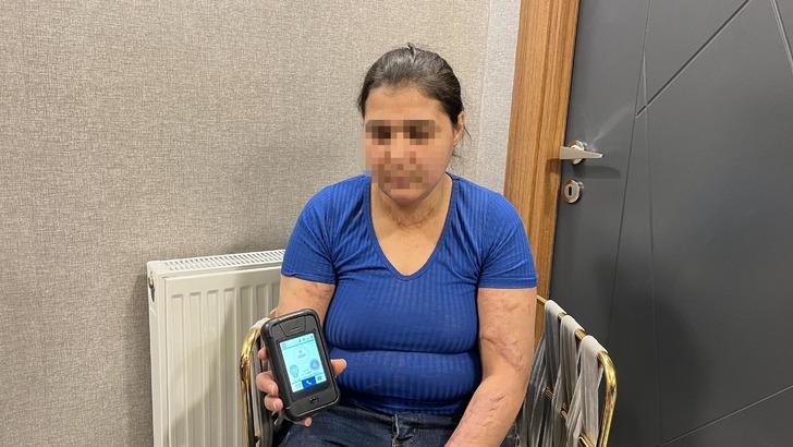 Her kelimesi insanlık dışı: Bacağına sıcak ütü bastılar, kolonya döküp canlı canlı yakmak istediler G2