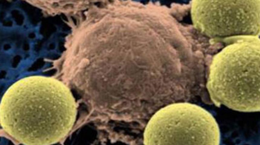 Kan kanseri tedavisinde 'seri katil' umudu