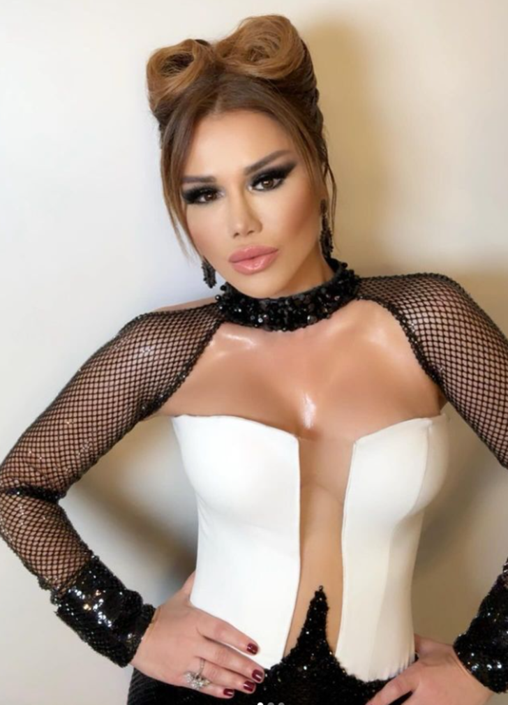 Yüzündeki değişimle çok konuşulmuştu... Şarkıcı Ceylan'ın gözlüklerinin fiyatı dudak uçuklattı G1