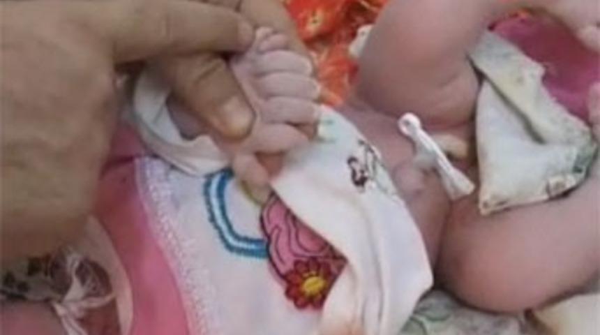 25 parmaklı bebek doğdu!