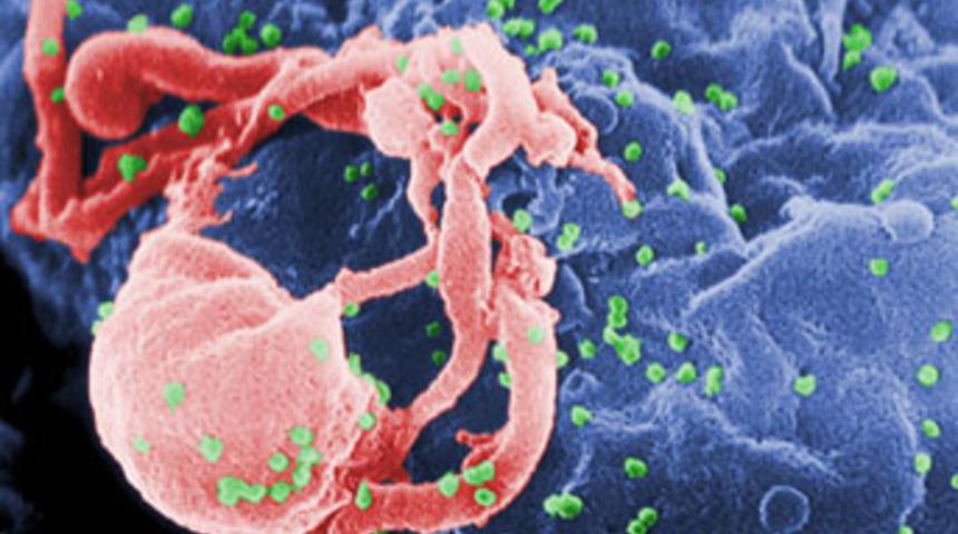 HIV'i devre dışı bırakmanın yolu bulundu