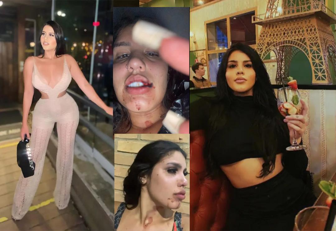 &Ccedil;ılgın fenomen partisinde korkun&ccedil; iddialar! İla&ccedil; verilerek uyuşturulduğunu s&ouml;yleyen fenomen tecav&uuml;ze uğradığını iddia etti... Y&uuml;z&uuml; g&ouml;z&uuml; kan i&ccedil;indeydi