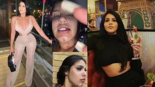 Çılgın fenomen partisinde korkunç iddialar! İlaç verilerek uyuşturulduğunu söyleyen fenomen tecavüze uğradığını iddia etti... Yüzü gözü kan içindeydi