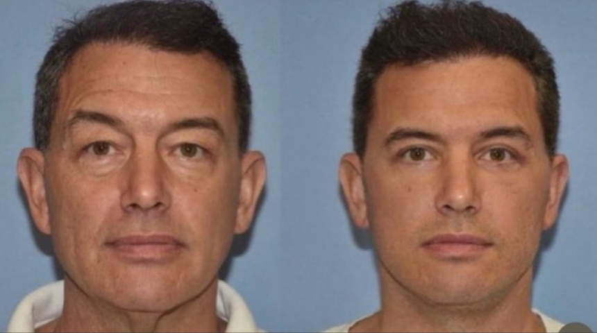 Amerikalı bir estetik cerrahının yaptığı gençleştirme operasyonu sosyal medyada gündem oldu! Gören tanımayadı... "Oğlu zannettim"