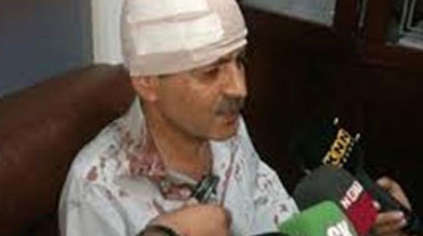 K&uuml;rt gazeteciye &ouml;l&uuml;m&uuml;ne dayak