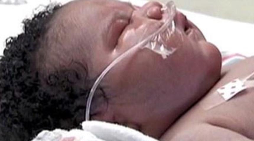 7 kilo 300 gram doğdu