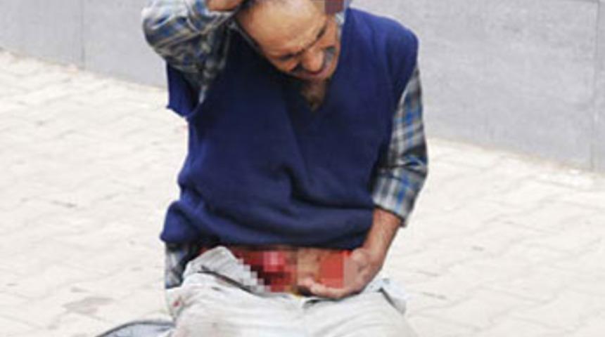 Kavgada 'bağırsak' d&ouml;k&uuml;ld&uuml;