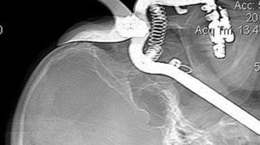 Bah&ccedil;e makası g&ouml;z&uuml;ne girdi