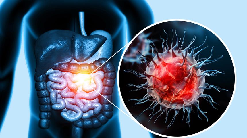 Bu belirtiler varsa dikkat! Bağırsaklarınızda emilim bozukluğu olabilir