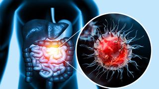 İhtiyaç fazlası tüketildiğinde kanser riskini artırıyor! DSÖ'ye göre en fazla 2. ölüm nedeni... Erkeklerde daha sık görülüyor