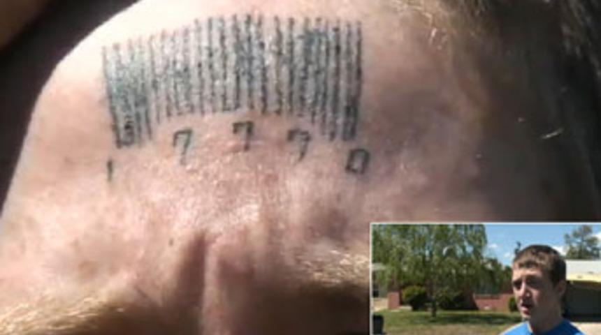 Alnına 'tecav&uuml;zc&uuml;' d&ouml;vmesi yapıldı