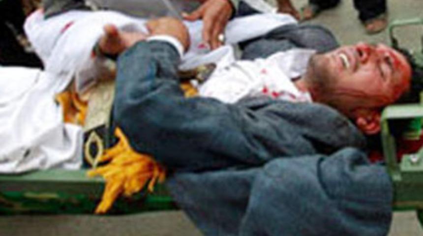 Yemen'de patlama: 110 &ouml;l&uuml;