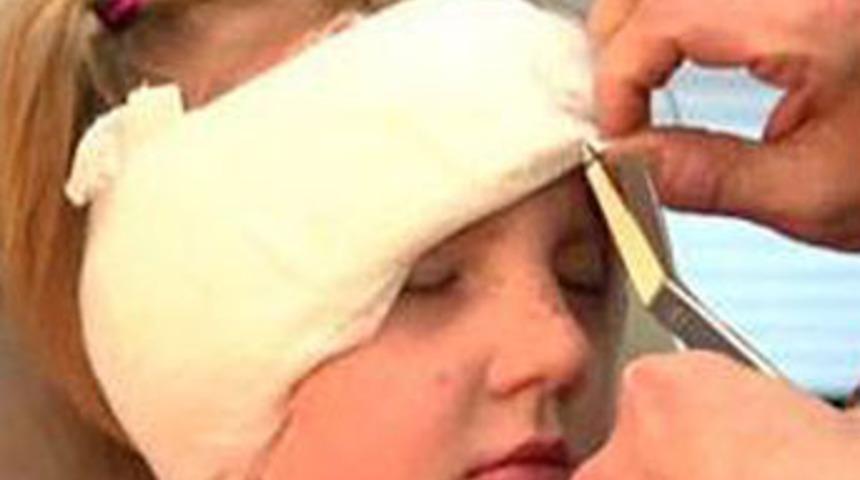 7 yaşında estetik ameliyat oldu