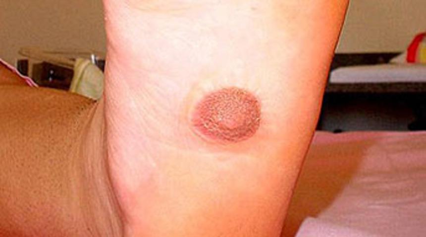 Ayağının altında &uuml;&ccedil;&uuml;nc&uuml; meme &ccedil;ıktı!..