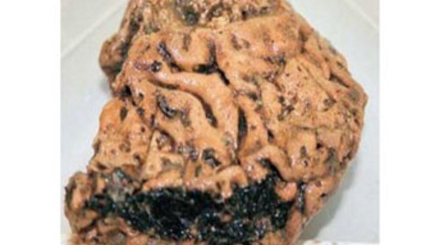 2500 yıllık erkek beyni bulundu