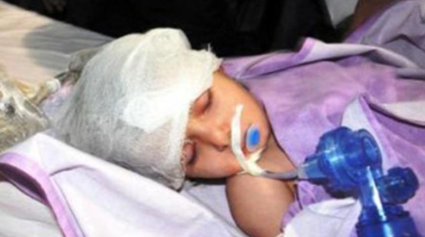 2 yaşındaki Elif'in başına gaz bombası