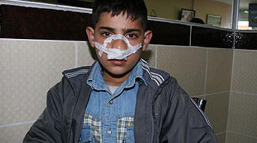 &Ouml;ğretmen dayağı bu hale getirdi!