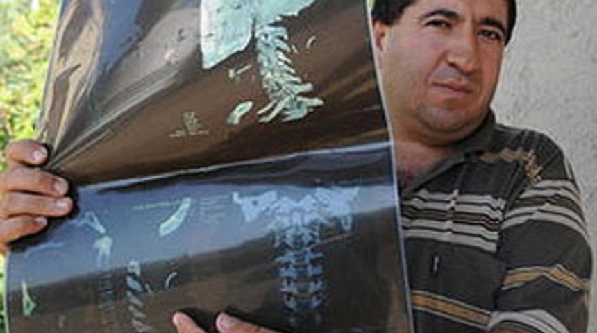 Kafasında iğne unuttular!