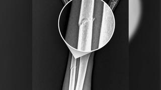 Trabzonspor kötü haberi resmen açıkladı! Onuachu'nun kolunda kırık tespit edildi