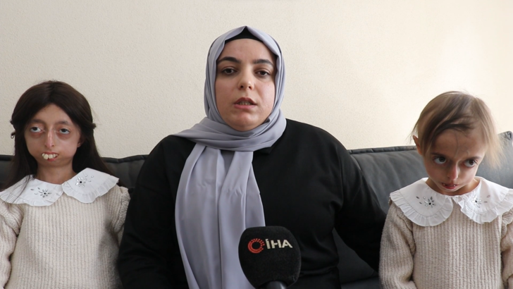 Biri 10 diğeri 13 yaşında! 8 milyonda bir görülen yaşlanma hastalığına yakalandılar: Hayalleri yıldız futbolcuyla bir araya gelmek G3