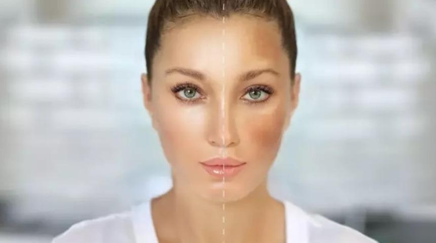 Uzman isim açıkladı: Bazı hastalıklar cilt lekelerine yol açabiliyor! İşte çözüm yolları