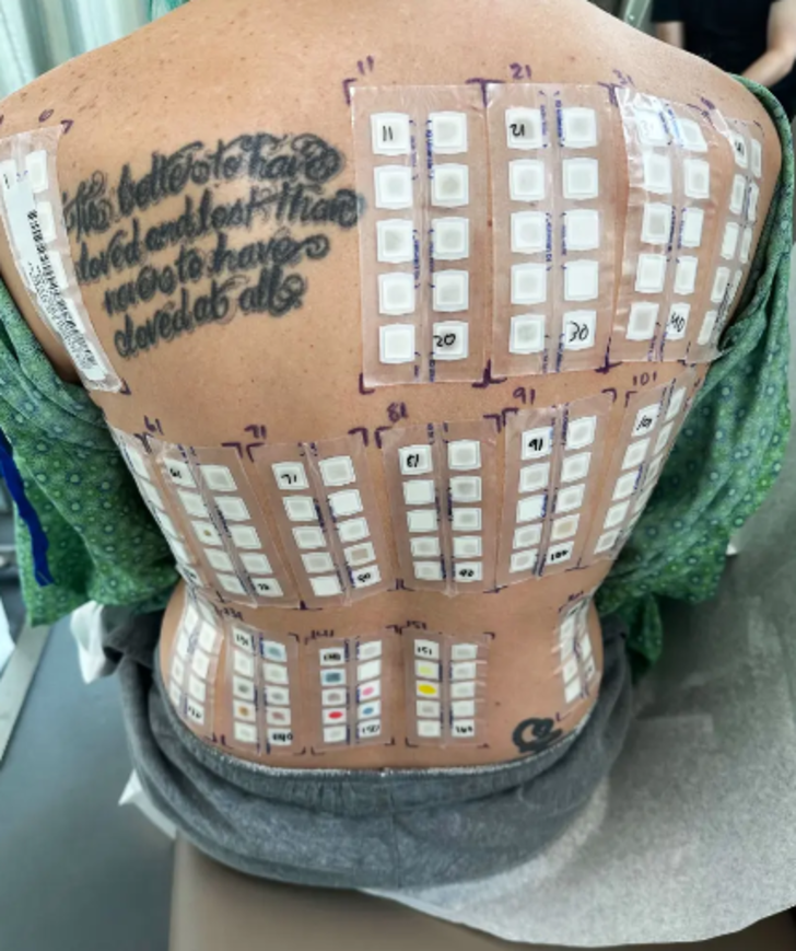 'Meniye alerjim var' dedi... Sosyal medyada itirafı gündem yarattı: "Seks hayatım bir mücadeleye dönüştü" G2