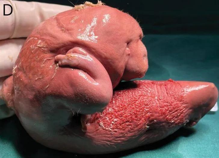 1 yaşındaki bebek kafası geniş olduğu için hastaneye getirildi: İnanılmaz gerçek ortaya çıktı! İkizi beyninin içindeymiş...