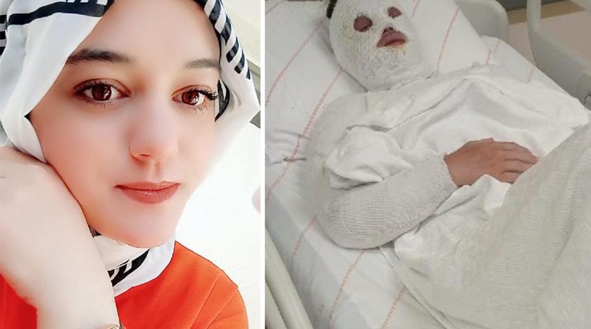 Eski nişanlının yüzüne kimyasal atmıştı! Mahkemeden emsal karar: 15 yıl hapis cezası az bulundu