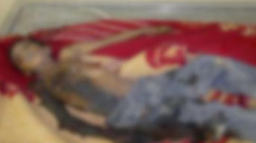 &Ccedil;ocuklara misket bombası!..