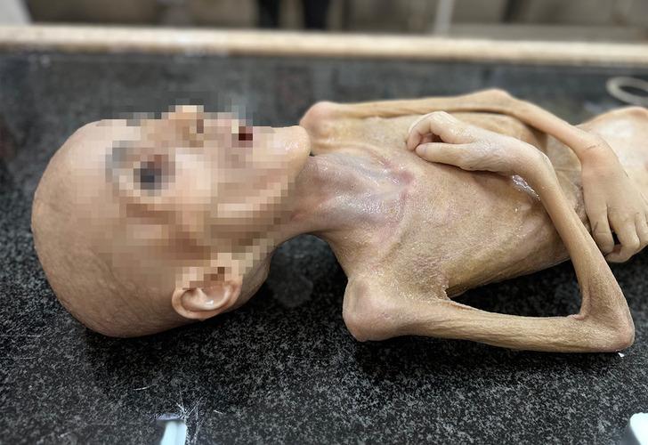 Filistin'de insanlık tarihini utandıracak fotoğraf! Günden güne eridi, bir deri bir kemik kaldı: "Oğlumun böyle olacağı aklıma gelmezdi" G2