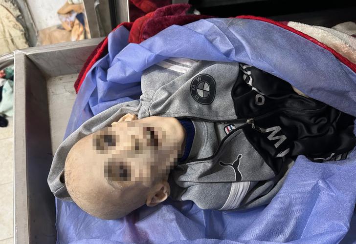 Filistin'de insanlık tarihini utandıracak fotoğraf! Günden güne eridi, bir deri bir kemik kaldı: "Oğlumun böyle olacağı aklıma gelmezdi" G3