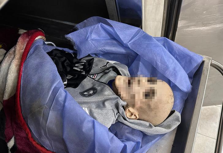 Filistin'de insanlık tarihini utandıracak fotoğraf! Günden güne eridi, bir deri bir kemik kaldı: "Oğlumun böyle olacağı aklıma gelmezdi" G4