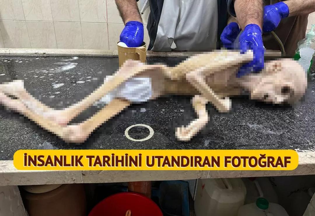 Filistin'de insanlık tarihini utandıracak fotoğraf! G&uuml;nden g&uuml;ne eridi, bir deri bir kemik kaldı: "Oğlumun b&ouml;yle olacağı aklıma gelmezdi"