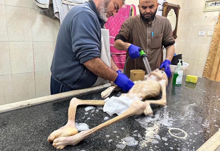 Filistin'de insanlık tarihini utandıracak fotoğraf! Günden güne eridi, bir deri bir kemik kaldı: "Oğlumun böyle olacağı aklıma gelmezdi" G1