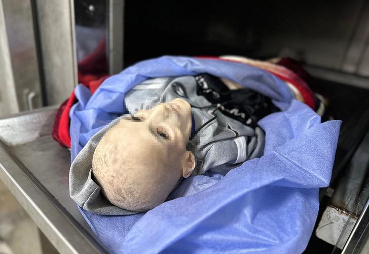 Filistin'de insanlık tarihini utandıracak fotoğraf! Günden güne eridi, bir deri bir kemik kaldı: "Oğlumun böyle olacağı aklıma gelmezdi" G5