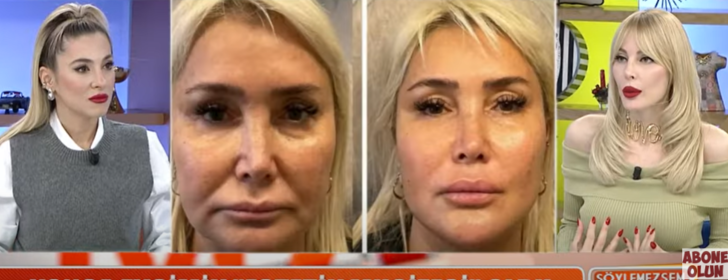 Hande Sarıoğlu canlı yayında estetiklerini tek tek saydı! Göğüs itirafı olay oldu G2