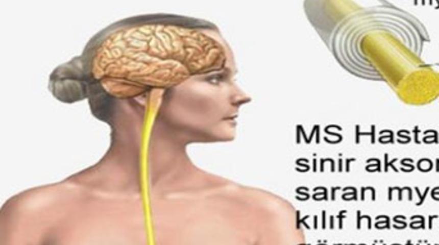 MS tedavisinde y&uuml;zde 70 başarı