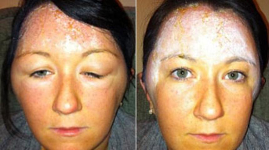 Saç boyası öldürüyordu