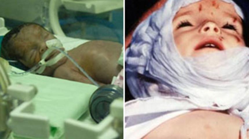 PKK vahşetinin değişmeyen y&uuml;z&uuml;