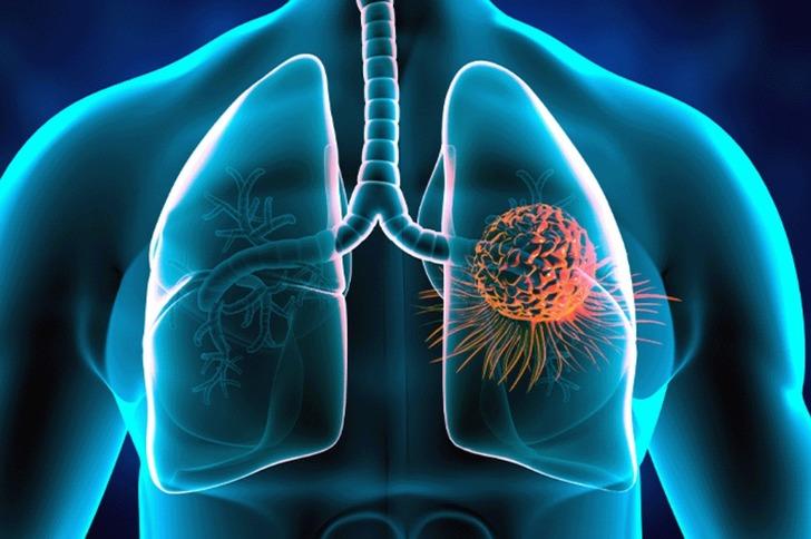 Uzmanları uyardı: 50 yaş altı vakalarda artış yaşanıyor! 'Z kuşağı için büyük önem taşıyor' G3