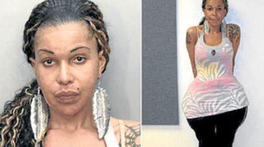 Kal&ccedil;ası taş kesti