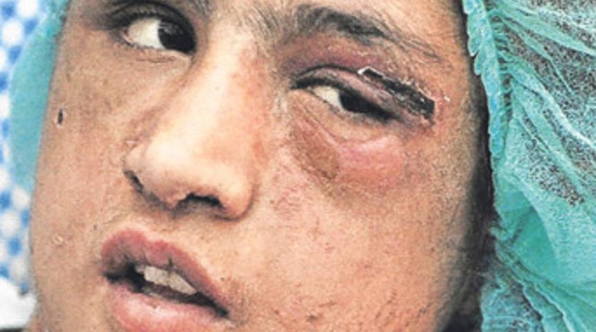 &Ccedil;ocuk gelinin ilk fotoğrafları