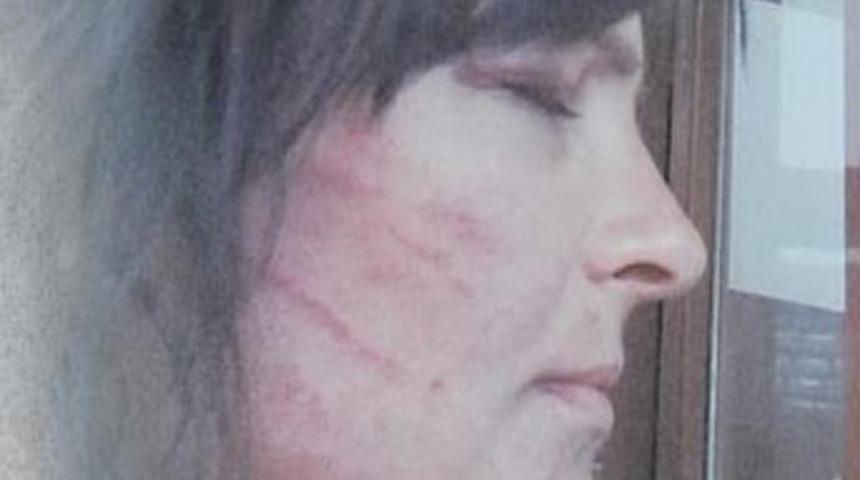 Karakolda dayak yiyen kadın ifade verdi