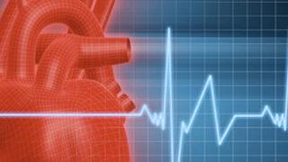 Aort anevrizmasının belirtileri