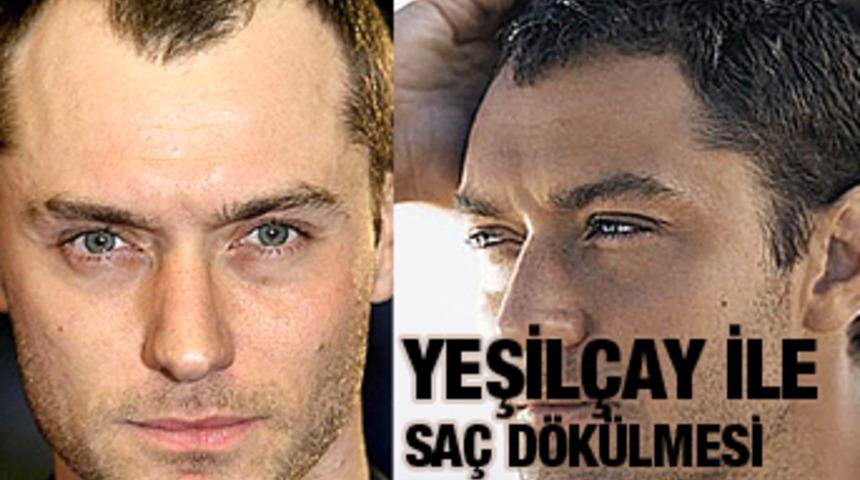 Saç Dökülmesine Yeşil Çay