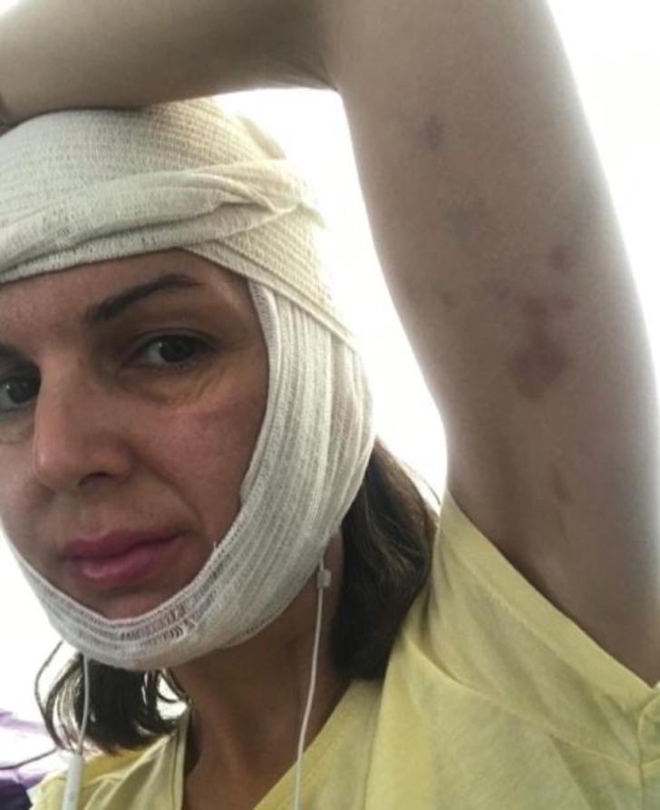 Güzellik merkezinde akılalmaz olay: Topuklu ayakkabı sesinden rahatsız olmuş! "Boks torbasını yumruklar gibi vurmuş" G3