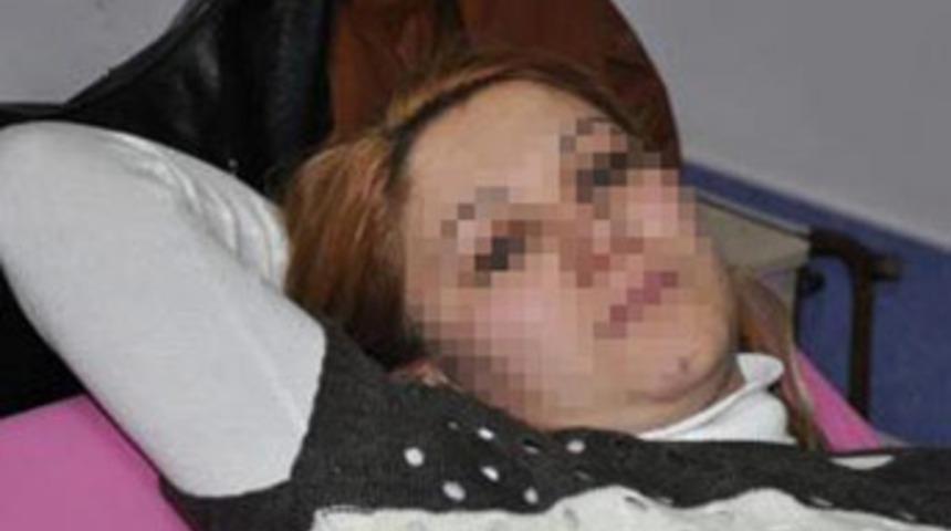 Kadına sokak ortasında önce taciz sonra dayak