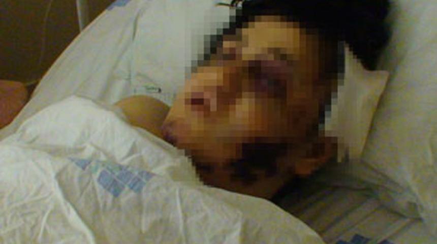 Eşini keserle dövüp üzerine kaynar su döktü