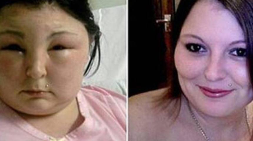 Saçlarını boyadı, kör oldu